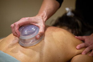 Cupping Therapy
